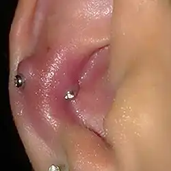 Piercing infectado oreja